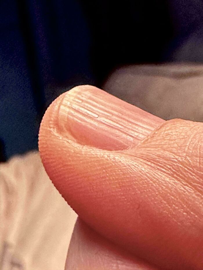 The Wildest Body Stuff People Hide (But Not Anymore!)