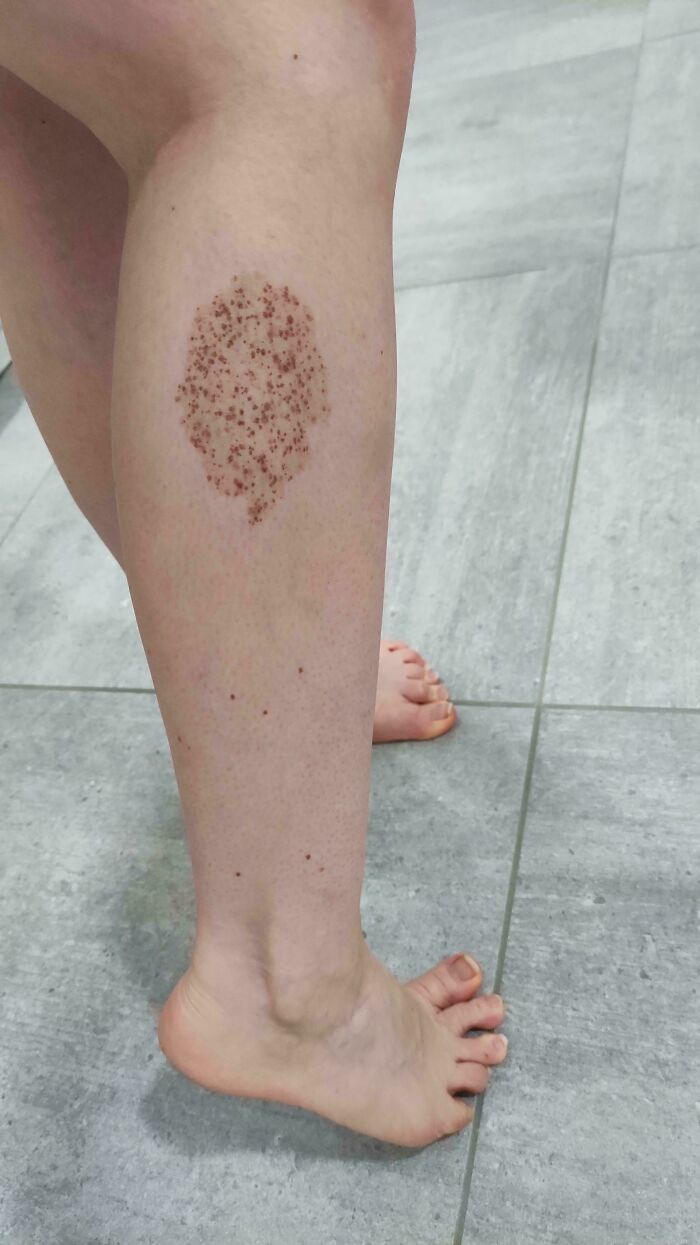 The Wildest Body Stuff People Hide (But Not Anymore!)