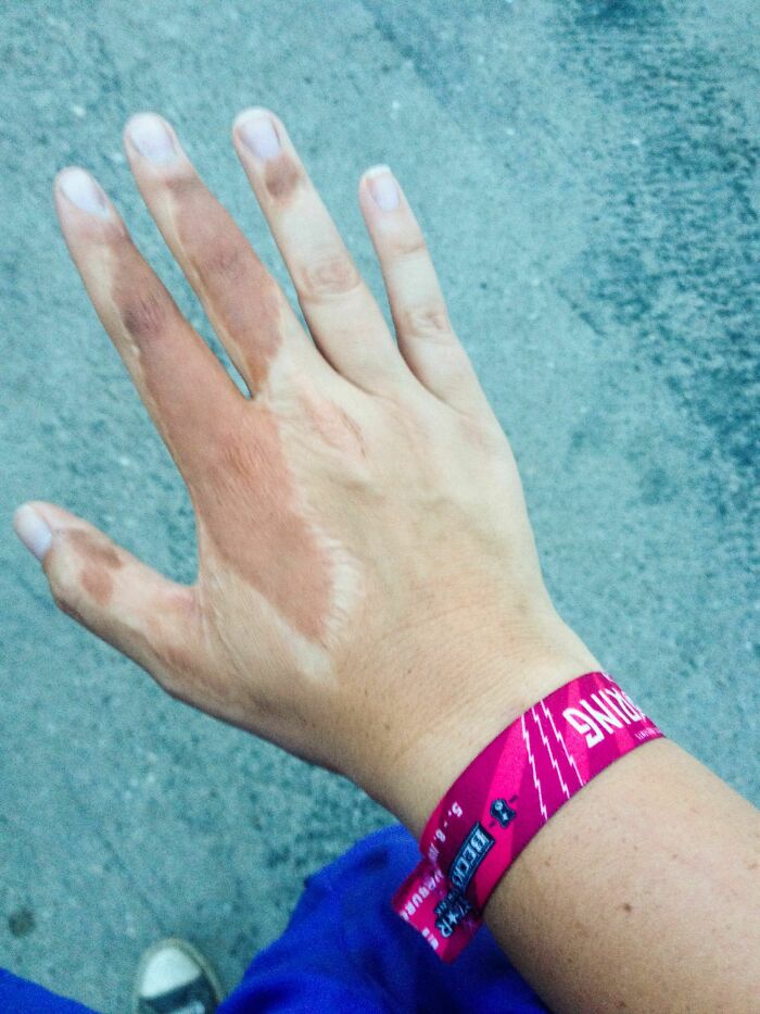 The Wildest Body Stuff People Hide (But Not Anymore!)