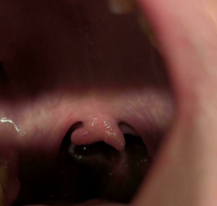 The Wildest Body Stuff People Hide (But Not Anymore!)