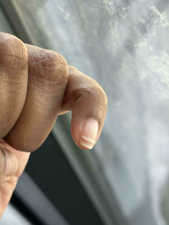 The Wildest Body Stuff People Hide (But Not Anymore!)