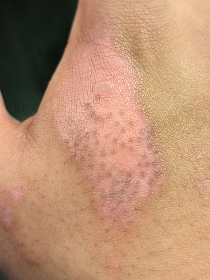 The Wildest Body Stuff People Hide (But Not Anymore!)