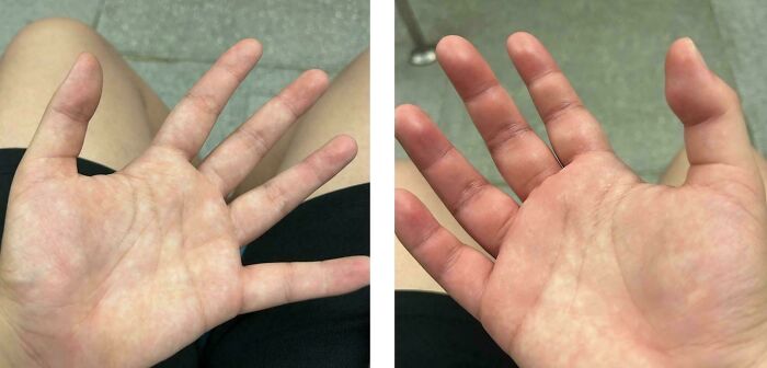 The Wildest Body Stuff People Hide (But Not Anymore!)