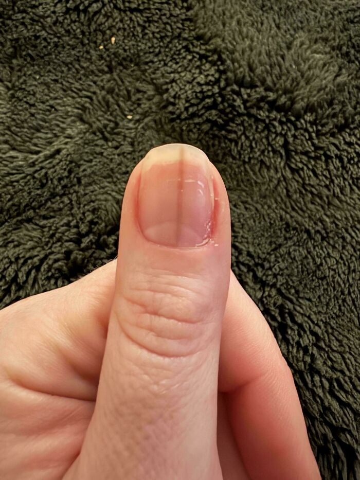 The Wildest Body Stuff People Hide (But Not Anymore!)