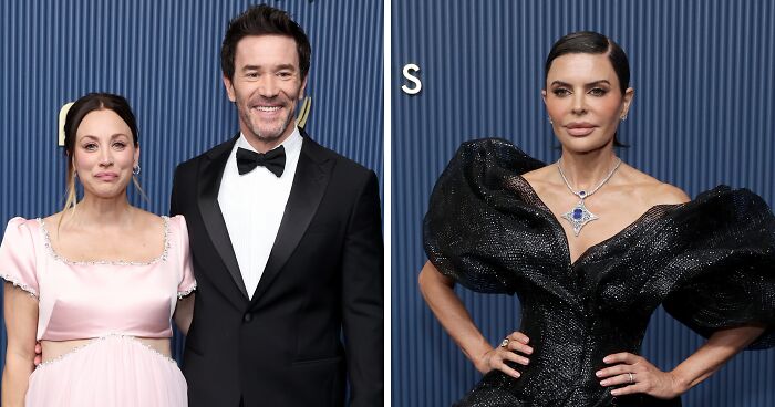 Wait, They Actually Guessed These Stars Had Plastic Surgery at the 2026 Emmys?!