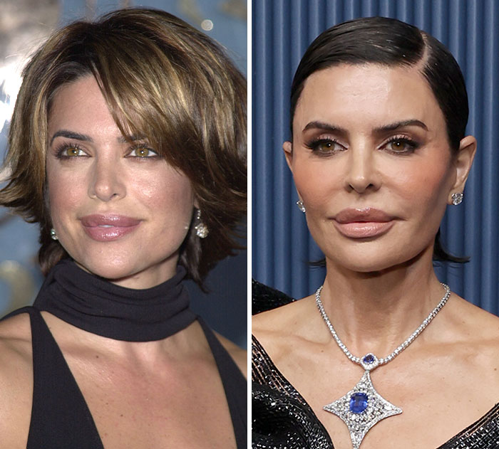 Lisa Rinna: The ‘Did She Fire The Surgeon?’ Look