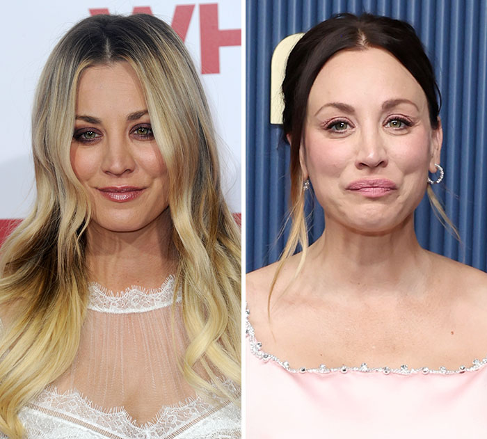 Kaley Cuoco: Baby Bump and Botox Confessions