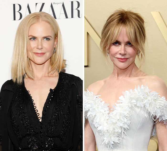 Nicole Kidman: Face Talk and Fake Hip Theories