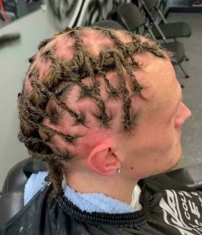 Ouch! The Cut That Hurts Your Eyes