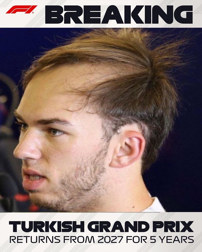 Breaking News: This Hairline is a Disaster