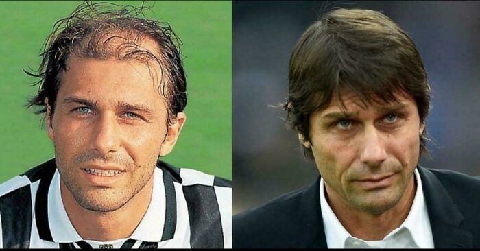 Antonio Conte’s Hair Transformation Is Unreal