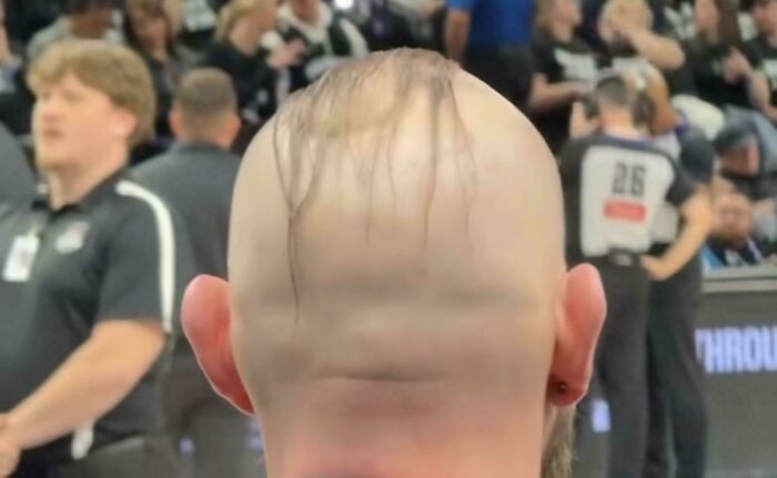 Security Guard’s Nuggets vs. Minnesota Hair Situation