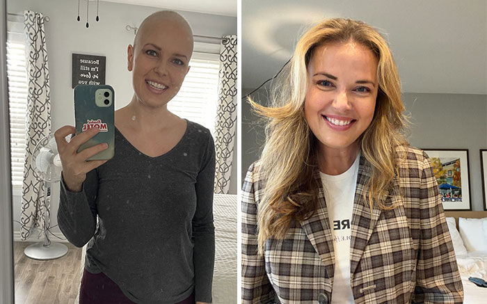 First Chemo vs. 5 Years Cancer Free – The Glow-Up Chronicles
