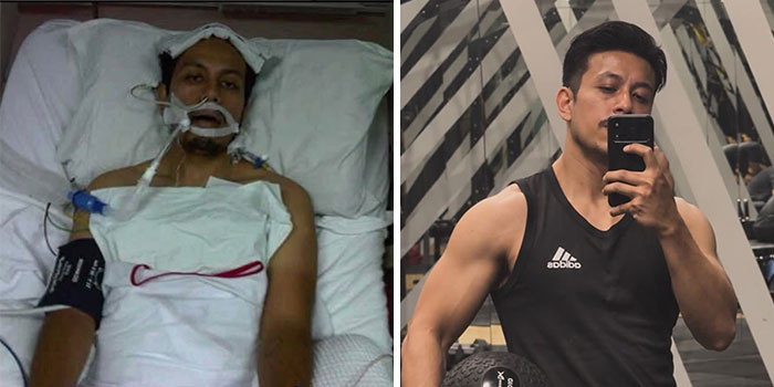 Cancer Fighter Turned Survivor – Talk About A Glow-Up!