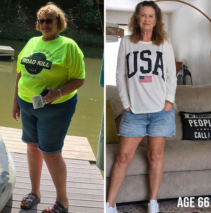 317 lbs to 179 lbs – A Glow-Up for the Books