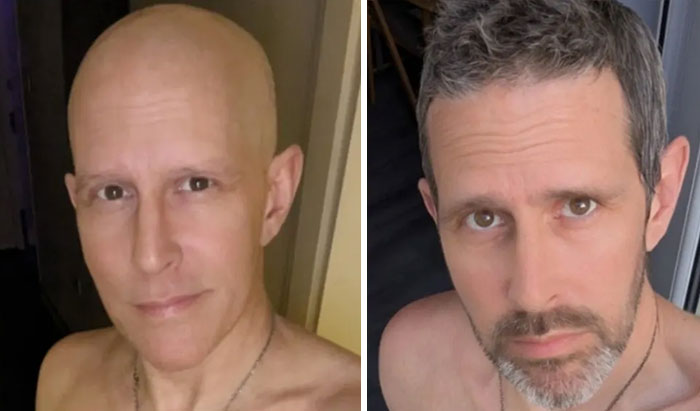 During and After Chemo – Sending Big Hugs and Glow-Up Vibes