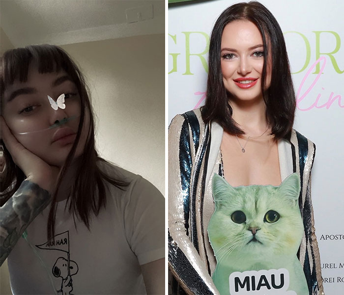 2024 Myasthenia Gravis Crisis vs. 2026 In Remission – Jaws Dropped