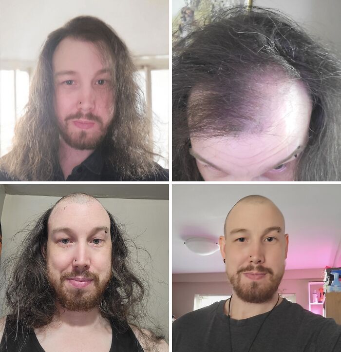 When I Finally Got Over It (And My Hair Did Too)