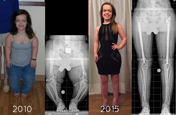 Growing Up: From 3’10" to Nearly 5 Feet!