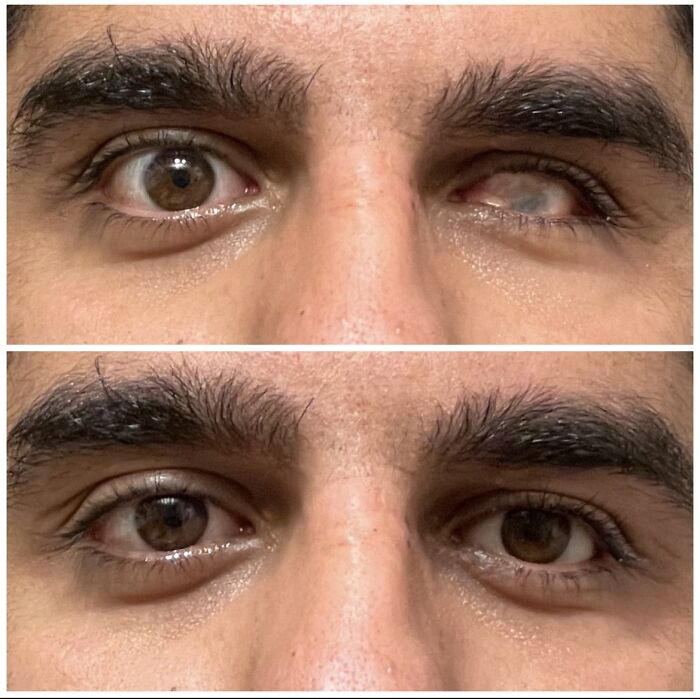 Fake Eye On: Instant Confidence Boost