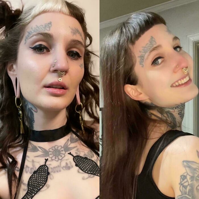 Ears Reconstructed: Almost 3 Years Healed