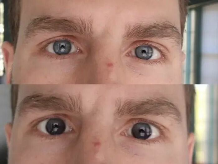 Transition Contacts Going Solar: Before and After