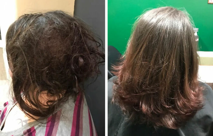 Depression Hair: Before and After