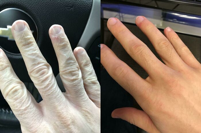 Lotion Power: Before and After