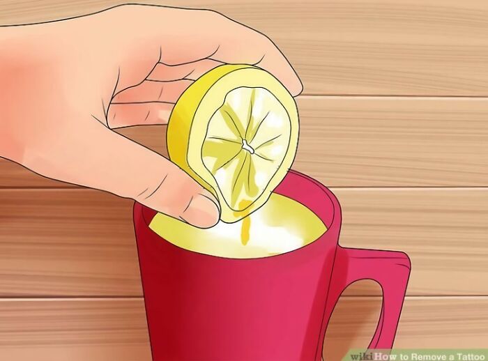How To Remove A Tattoo (Bye Bye Ink)