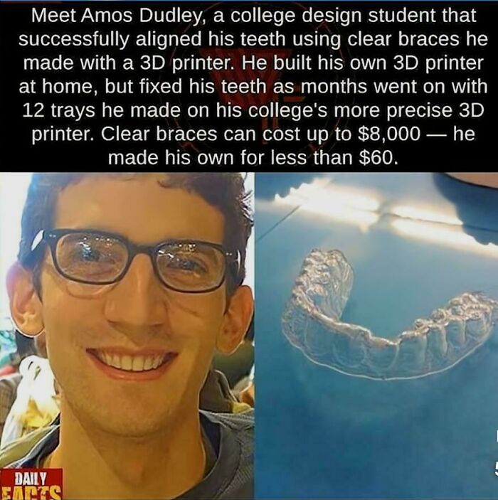 Healthcare costs got you down? Just 3D print your way out, college kid!