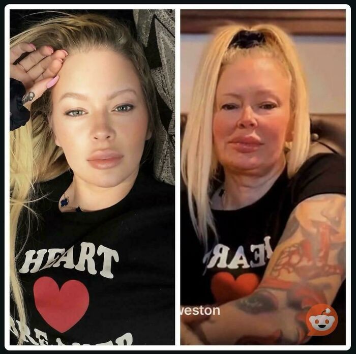 The Classic Post vs. Live Reality