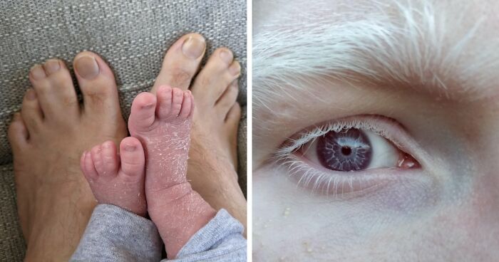 Let’s Peek at 75 Wild Body Quirks People Actually Rock!