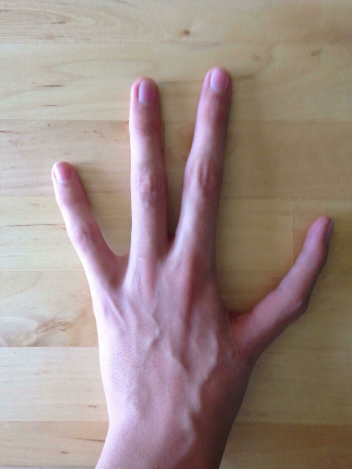 Four Fingers but No Thumb? That’s My Style