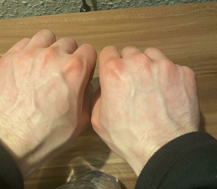 My Hand Veins Speak for Themselves: One Says 'yo,' The Other 'hi'
