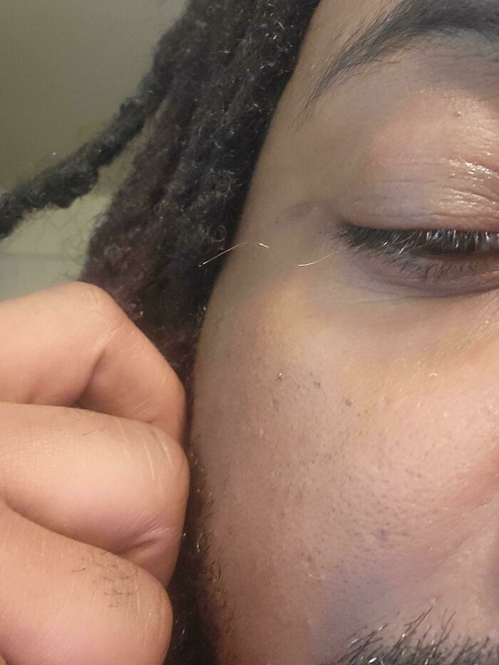 My Left Eye Grows a Single Long, Delicate Grey Eyelash — Magic!