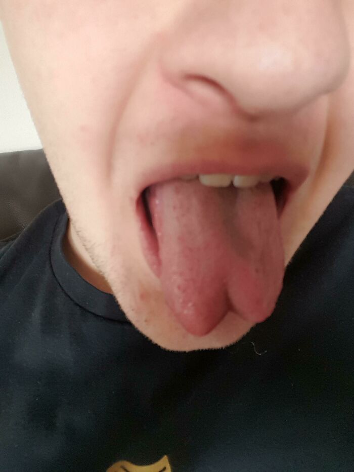 My Tongue Is Naturally Forked — Sneaky Snake Vibes!