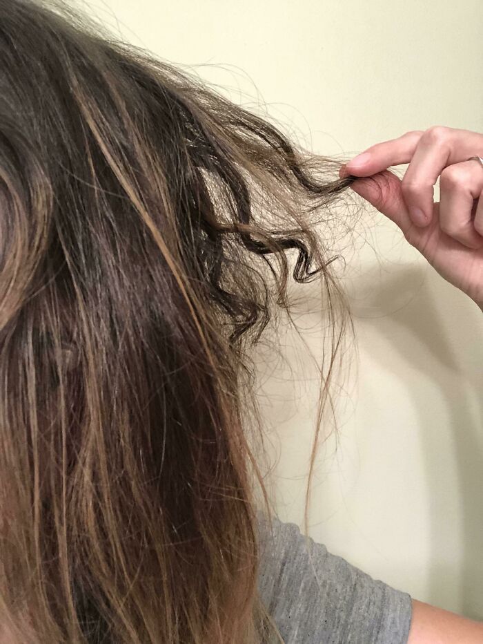 Patch of Hair Fell Out and Came Back Curly — Surprise!