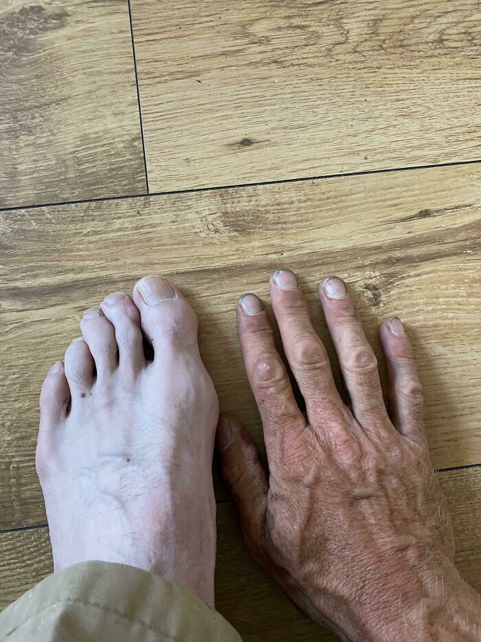 Working Outdoors Turns My Hand and Foot into Different Colors — Nature’s Paint Job