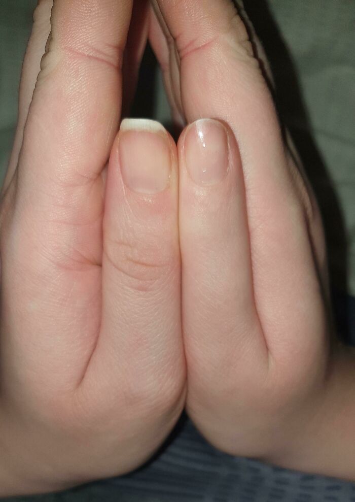 Let’s Peek at 75 Wild Body Quirks People Actually Rock!