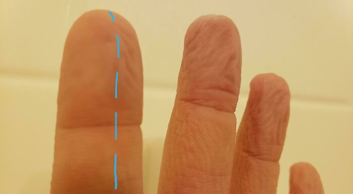 Let’s Peek at 75 Wild Body Quirks People Actually Rock!