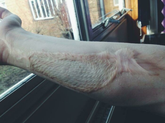Let’s Peek at 75 Wild Body Quirks People Actually Rock!