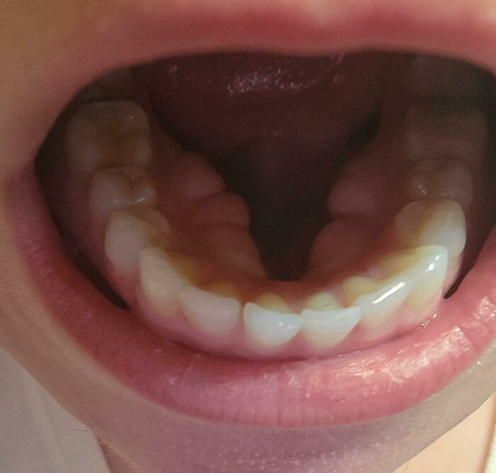 Let’s Peek at 75 Wild Body Quirks People Actually Rock!