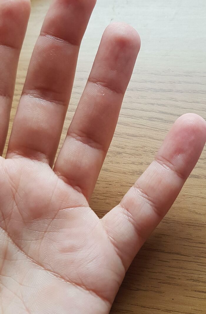 Let’s Peek at 75 Wild Body Quirks People Actually Rock!
