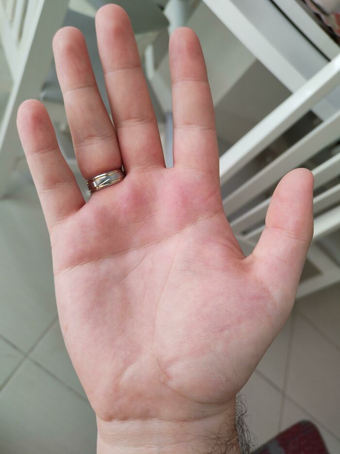 Let’s Peek at 75 Wild Body Quirks People Actually Rock!